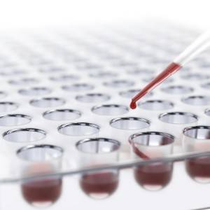 Lab Mistakes